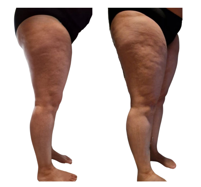 ogen bella.3png